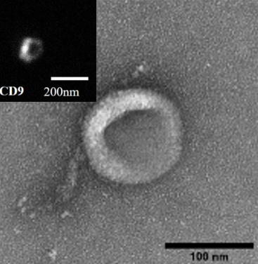 Extracellular vesicle characterization
